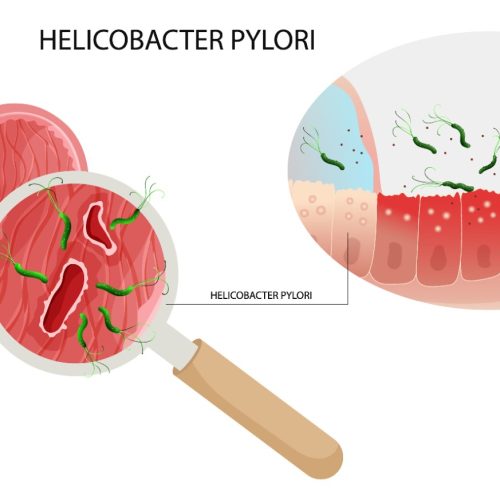Helikobakter Pilori