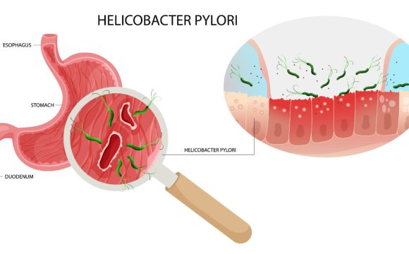 Helikobakter Pilori