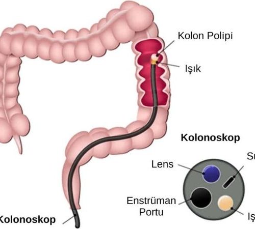 Kolonoskopi İşlemi